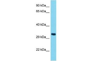 Host: Rabbit Target Name: TMPRSS9 Sample Type: Jurkat Whole Cell lysates Antibody Dilution: 1. (TMPRSS9 Antikörper  (C-Term))