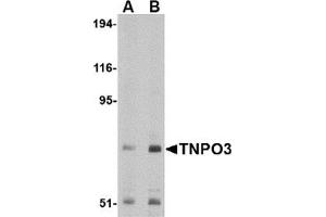 Western blot analysis of TNPO3 in Raji cell lysate with TNPO3 antibody at (A) 1 and (B) 2 μg/ml.