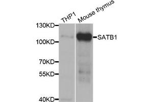 Western blot analysis of extracts of various cell lines, using SATB1 antibody. (SATB1 Antikörper)