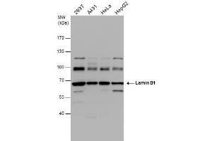 WB Image Lamin B1 antibody detects Lamin B1 protein by western blot analysis. (Lamin B1 Antikörper)