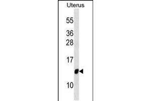 Western blot analysis in Uterus tissue lysates (35ug/lane). (TIMM10 Antikörper  (AA 21-49))