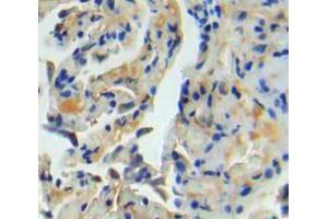 IHC-P analysis of lung tissue, with DAB staining. (TNC Antikörper  (AA 174-621))
