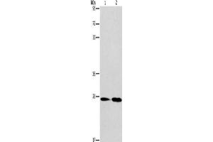 Gel: 8 % SDS-PAGE, Lysate: 40 μg, Lane 1-2: Mouse kidney tissue, Mouse liver tissue, Primary antibody: ABIN7130344(NAT8 Antibody) at dilution 1/237. (NAT8 Antikörper)