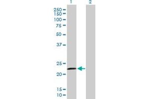 Western Blot analysis of RASGEF1B expression in transfected 293T cell line by RASGEF1B MaxPab polyclonal antibody. (RASGEF1B Antikörper  (AA 1-210))