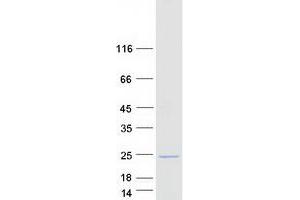 Western Blotting (WB) image for Coiled-Coil Domain Containing 43 (CCDC43) (Transcript Variant 2) protein (Myc-DYKDDDDK Tag) (ABIN2713298)