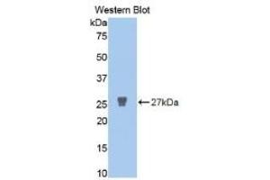 Western Blotting (WB) image for Matrix Metalloproteinase 2 (MMP2) ELISA Kit (ABIN6730864)