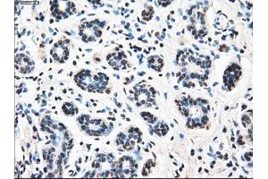 Immunohistochemical staining of paraffin-embedded breast tissue using anti-LEMD3 mouse monoclonal antibody. (LEMD3 Antikörper)