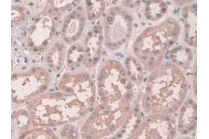 IHC-P analysis of Human Kidney Tissue, with DAB staining. (Connexin 43/GJA1 Antikörper  (AA 180-382))