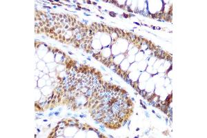 Immunohistochemistry of paraffin-embedded human colon using SP3 Rabbit pAb (ABIN6130701, ABIN6148314, ABIN6148315 and ABIN6216542) at dilution of 1:100 (40x lens). (Sp3 Antikörper  (AA 240-350))