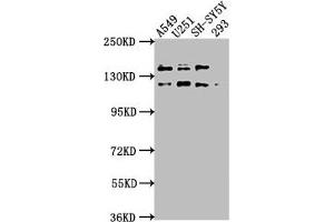 Western Blot Positive WB detected in: A549 whole cell lysate, U251 whole cell lysate, SH-SY5Y whole cell lysate, 293 whole cell lysate All lanes: TAOK1 antibody at 1:2000 Secondary Goat polyclonal to rabbit IgG at 1/50000 dilution Predicted band size: 117, 47, 98 kDa Observed band size: 117 kDa (TAO Kinase 1 (TAOK1) (AA 400-659) Antikörper)