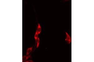ABIN6274612 staining HeLa by IF/ICC. (HCCS Antikörper  (Internal Region))