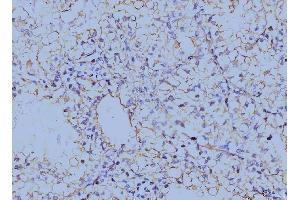 IHC analysis of Annexin VI using anti-Annexin VI antibody (ABIN7601597).