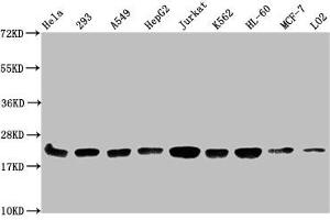 Western Blot Positive WB detected in: Hela whole cell lysate, 293 whole cell lysate, A549 whole cell lysate, HepG2 whole cell lysate, Jurkat whole cell lysate, K562 whole cell lysate, HL60 whole cell lysate, MCF-7 whole cell lysate, LO2 whole cell lysate All lanes: HIST1H1C antibody at 1:500 Secondary Goat polyclonal to rabbit IgG at 1/40000 dilution Predicted band size: 22 kDa Observed band size: 22 kDa (HIST1H1C Antikörper  (meLys186))