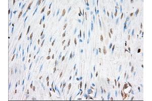 Immunohistochemical staining of paraffin-embedded Human colon tissue using anti-EIF2S1 mouse monoclonal antibody. (EIF2S1 Antikörper)