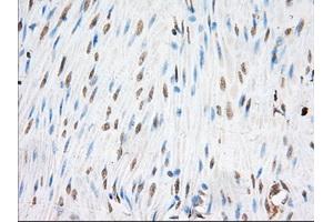 Immunohistochemical staining of paraffin-embedded Human colon tissue using anti-EIF2S1 mouse monoclonal antibody.