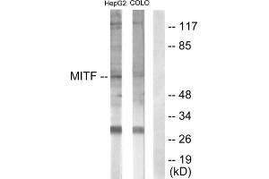 Western blot analysis of extracts from HepG2 cells (lane 1) and COLO205 cells (lane 2), using MITF (epitope around residue 180/73) antibody. (MITF Antikörper  (Ser73, Ser180))