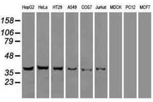 Image no. 2 for anti-DNA Fragmentation Factor, 45kDa, alpha Polypeptide (DFFA) antibody (ABIN1498772) (DFFA Antikörper)