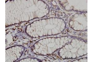 Image no. 2 for anti-CDK5 Regulatory Subunit Associated Protein 3 (CDK5RAP3) (AA 1-507) antibody (ABIN599311) (CDK5RAP3 Antikörper  (AA 1-507))