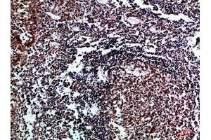 Immunohistochemical analysis of paraffin-embedded Human-tonsil, antibody was diluted at 1:100 (IL17D Antikörper  (AA 141-190))