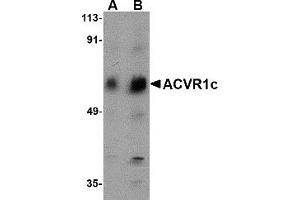 Western Blotting (WB) image for anti-Activin Receptor Type 1C (ACVR1C) (N-Term) antibody (ABIN1031213) (ACVR1C/ALK7 Antikörper  (N-Term))