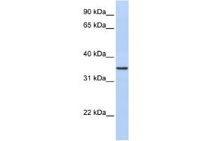 WB Suggested Anti-CDC42EP4 Antibody Titration: 0. (CDC42EP4 Antikörper  (N-Term))