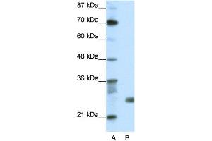 WB Suggested Anti-SAP30 Antibody Titration:  1. (SAP30 Antikörper  (N-Term))