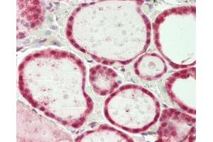 Immunohistochemistry (Paraffin-embedded Sections) (IHC (p)) image for anti-Splicing Factor 3b, Subunit 1, 155kDa (SF3B1) (AA 100-150) antibody (ABIN2628221)