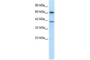 WB Suggested Anti-PRDM14 Antibody Titration: 1. (PRDM14 Antikörper  (Middle Region))
