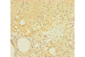 Immunohistochemistry of paraffin-embedded human adrenal gland tissue using ABIN7158796 at dilution of 1:100 (LAPTM5 Antikörper  (AA 205-262))