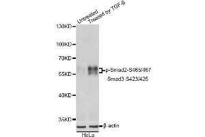 Western blot analysis of extracts of HeLa cells, using Phospho-Smad2-S465/467/-Smad3-S423/425 antibody. (SMAD2 / SMAD3 (pSer423), (pSer425) Antikörper)