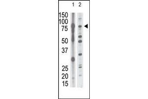The anti-P15 N-term Antibody (ABIN390139 and ABIN2840643) is used in Western blot to detect P15 in mouse brain tissue lysate (lane 1) and HL60 cell lysate (lane 2) lysate. (MMP15 Antikörper  (N-Term))
