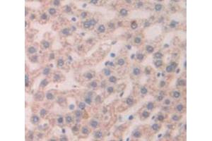 IHC-P analysis of Rat Tissue, with DAB staining. (Thymic Stromal Lymphopoietin Antikörper  (AA 75-196))