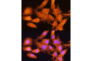 Immunofluorescence analysis of C6 cells using AIRE Rabbit pAb (ABIN3022514, ABIN3022515, ABIN3022516 and ABIN6218869) at dilution of 1:100. (AIRE Antikörper  (AA 30-130))