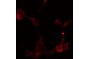 ABIN6274886 staining HeLa cells by IF/ICC. (ABCF1 Antikörper  (C-Term))