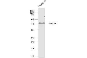 Mouse cerebrum lysates probed with WWOX Polyclonal Antibody, Unconjugated  at 1:500 dilution and 4˚C overnight incubation.