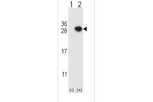 Western blot analysis of ARHGDIA using rabbit polyclonal ARHGDIA Antibody using 293 cell lysates (2 ug/lane) either nontransfected (Lane 1) or transiently transfected (Lane 2) with the ARHGDIA gene.