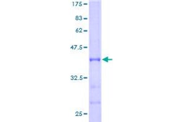 ABAT Protein (AA 1-116) (GST tag)