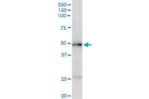Immunoprecipitation of ACADM transfected lysate using anti-ACADM MaxPab rabbit polyclonal antibody and Protein A Magnetic Bead , and immunoblotted with ACADM purified MaxPab mouse polyclonal antibody (B01P) . (Medium-Chain Specific Acyl-CoA Dehydrogenase, Mitochondrial (MCAD) (AA 1-421) Antikörper)