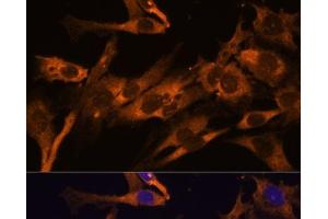 Immunofluorescence analysis of C6 cells using RPL36AL Polyclonal Antibody at dilution of 1:100 (40x lens).