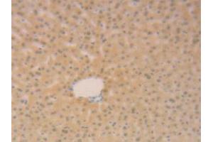 IHC-P analysis of Mouse Liver Tissue, with DAB staining. (SFTPB Antikörper  (AA 20-193))