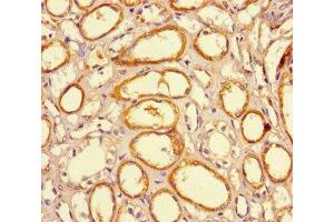 Immunohistochemistry of paraffin-embedded human kidney tissue using ABIN7165672 at dilution of 1:100 (JARID2 Antikörper  (AA 1-159))