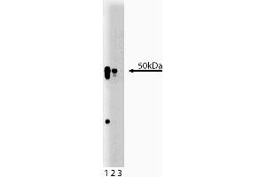 Western blot analysis of AP50 on a rat cerebrum lysate. (AP2M1 Antikörper  (AA 110-230))