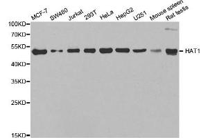 Western Blotting (WB) image for anti-Histone Acetyltransferase 1 (HAT1) antibody (ABIN1882320) (HAT1 Antikörper)