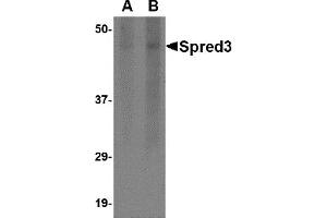 Western Blotting (WB) image for anti-Sprouty-Related, EVH1 Domain Containing 3 (SPRED3) (Middle Region) antibody (ABIN1031104)