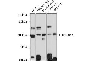 Western blot analysis of extracts of various cell lines, using IL1R antibody (ABIN1680448, ABIN3017765, ABIN3017766 and ABIN6220239) at 1:3000 dilution. (IL1RAPL1 Antikörper  (AA 130-210))