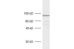Western Blotting (WB) image for anti-Membrane Protein, Palmitoylated 5 (MAGUK P55 Subfamily Member 5) (MPP5) (AA 2-244) antibody (ABIN1742447)