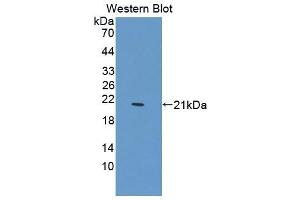 Detection of Recombinant PTPN13, Mouse using Polyclonal Antibody to Protein Tyrosine Phosphatase, Non Receptor Type 13 (PTPN13) (PTPN13 Antikörper  (AA 1-161))