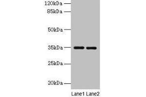 Western blot All lanes: Thpo antibody at 4 μg/mL Lane 1: Mouse liver tissue Lane 2: 293T whole cell lysate Secondary Goat polyclonal to rabbit IgG at 1/10000 dilution Predicted band size: 35 kDa Observed band size: 35 kDa (Thrombopoietin Antikörper  (AA 22-194))