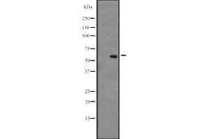 Western blot analysis of CLK3 expression in A431 whole cell lysate ,The lane on the left is treated with the antigen-specific peptide. (CLK3 Antikörper  (Internal Region))
