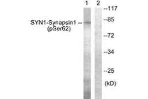 Western blot analysis of extracts from HeLa cells treated with Anisomycin 25ug/ml 30', using Synapsin1 (Phospho-Ser62) Antibody. (SYN1 Antikörper  (pSer62))